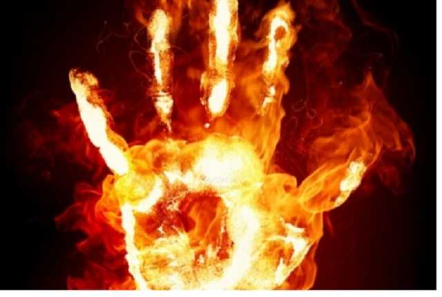 В столичном Гидропарке заживо сгорел охранник