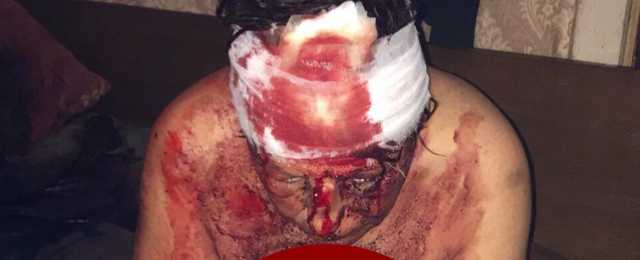 В Киеве нашли жестоко избитую окровавленную женщину: фото 18+