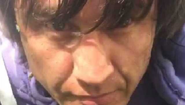 Покушение на одесского активиста: установлена личность киллера