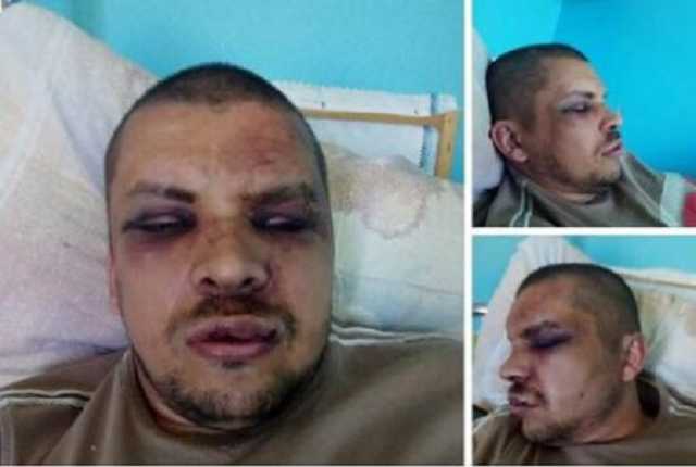 За георгіївську стрічку в Кременчуці чоловіку вибили 10 зубів