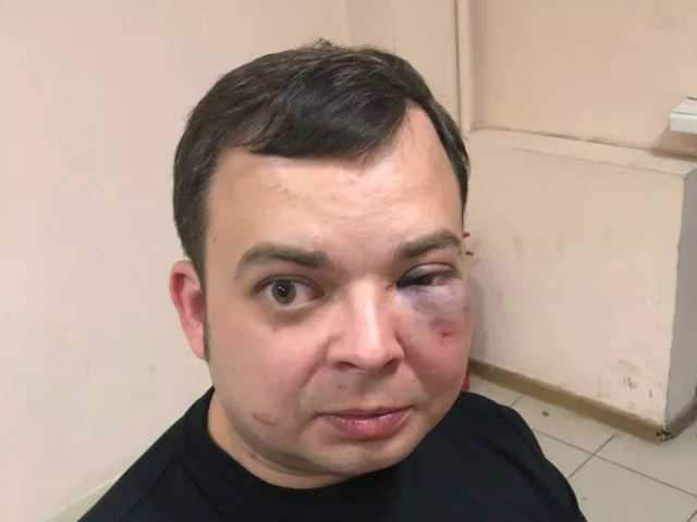 В Киеве избили сына Шуфрича