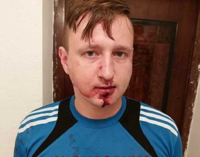 В Одессе избили проукраинского журналиста