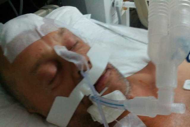 "Состояние критическое": появились новости о жестоко избитом россиянином украинце