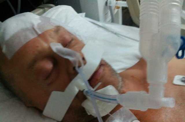 Россиянин напал на курорте: выяснилась судьба до полусмерти избитого украинца