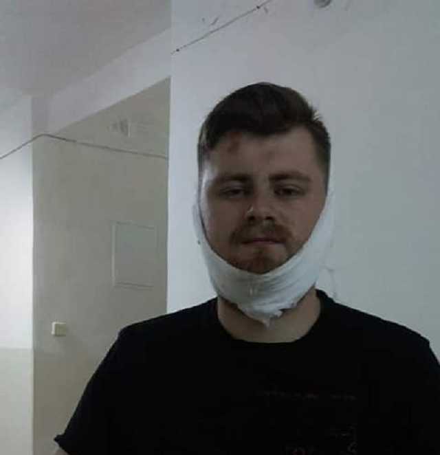 В Черкассах жестоко избили ветерана АТО