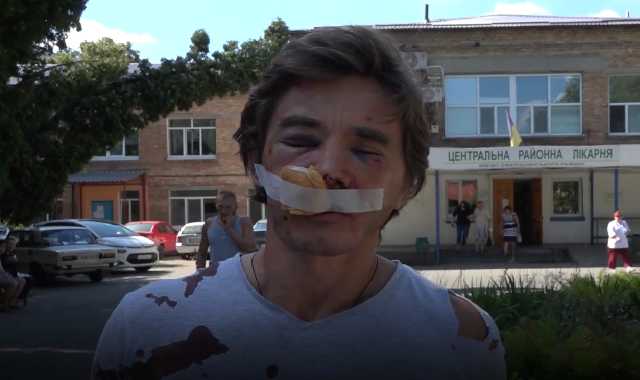 "Строят 13 высоток": под Киевом неизвестные зверски изуродовали активиста