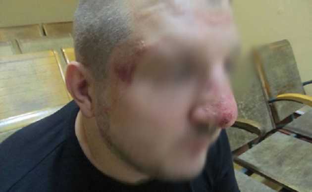 Российские пограничники избили украинца - Госпогранслужба