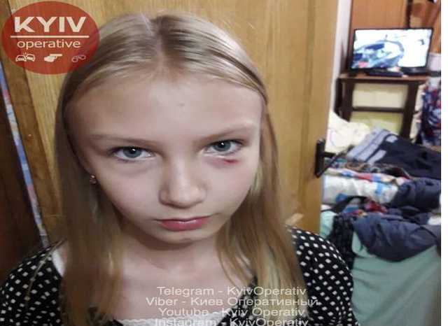 В Киеве пожилая женщина избила девочку и ее отца