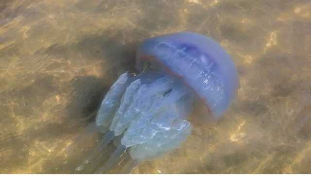 Морские твари атаковали побережье Одессы: пострадали полтысячи туристов