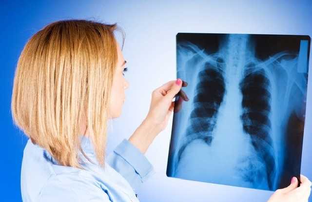 В Бердянском детском саду №35 выявлен туберкулез. Власти замалчивали инцидент