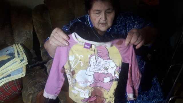 Животное набросилось на девочку: в Мариуполе крыса чуть не загрызла 4-летнюю малышку