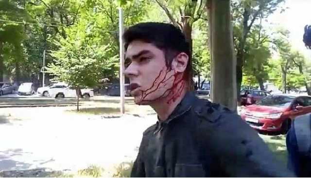 Нападение на главу одесского "Автомайдана": одного из подозреваемых арестовали