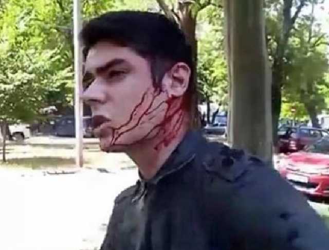 Подозреваемый в нападении на одесского активиста Устименко оказался дезертиром