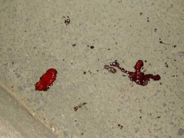 У кладбища в Одессе нашли избитого иностранца без сознания