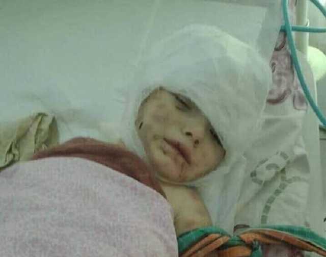 Собака отгрызла уши и пальцы: в Славянске произошло жуткое ЧП с ребенком