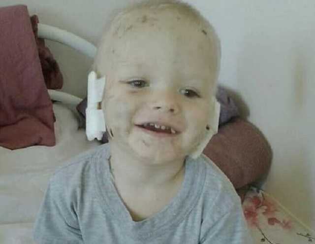 Без ушей и пальцев: искусанный собакой ребенок из Славянска нуждается в помощи