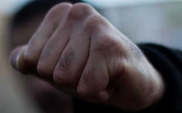 Подвійний перелом щелепи: У Харкові п’яні грабіжники увірвалися до квартири та побили господаря