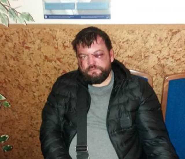 У центрі Львова жорстоко побили АТОвця. Шукають свідків