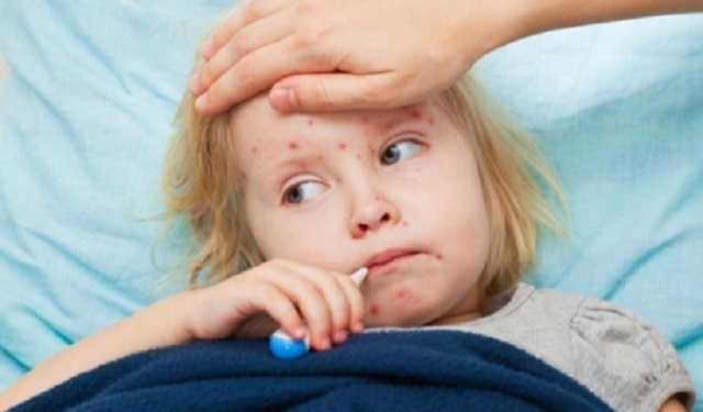 В Харьковской области за неделю корью заболели 40 человек