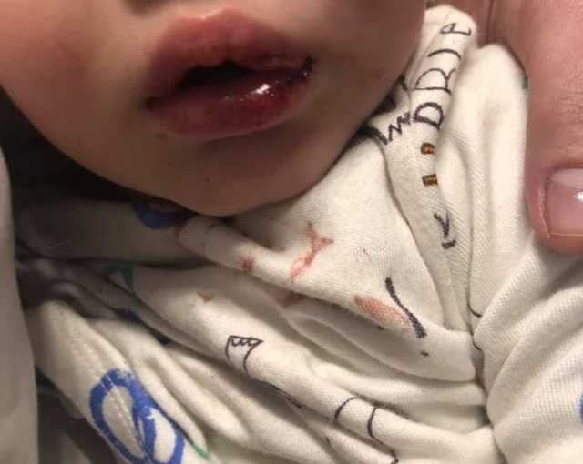 В Одессе пьяная няня избила годовалого малыша