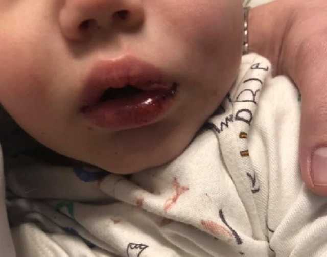 В Сети показали фото одесской няни, избившей до полусмерти малыша