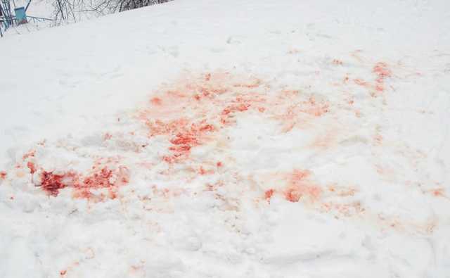 В Днепре на студента-иностранца напали с ножом