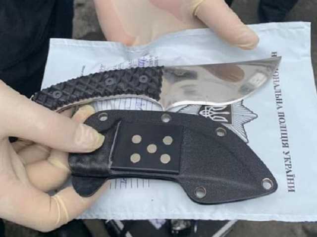 Сегодня зеленка, завтра – серная кислота: в полиции констатировали рост агрессии против правоохранителей