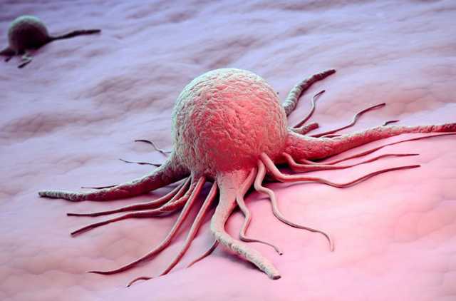 Прорыв в борьбе с раком: в Украине тестируют уникальную технику операции