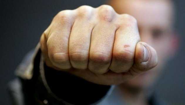 Под Киевом толпа подростков избила парня, который хотел помочь девушке