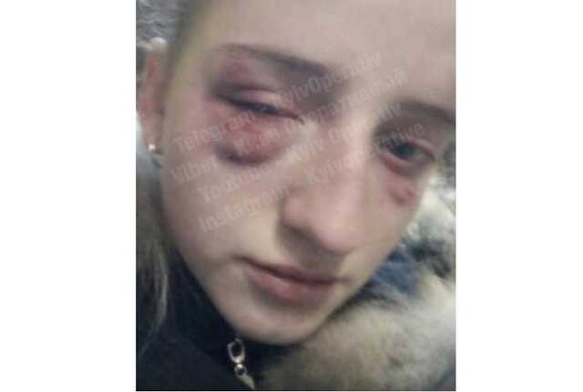 В столице правоохранители устанавливают личность зверски избитой школьницы