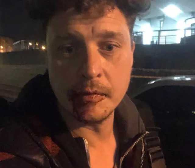 За вопросы о России в киевском ресторане избили известного режиссера