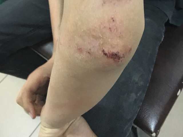 В Днепре мужчина ногами избил 12-летнего мальчика