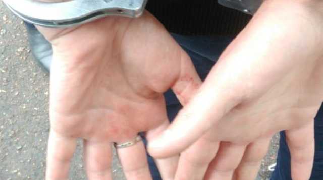 В Житомире студент с ножом напал на товарища в общежитии колледжа