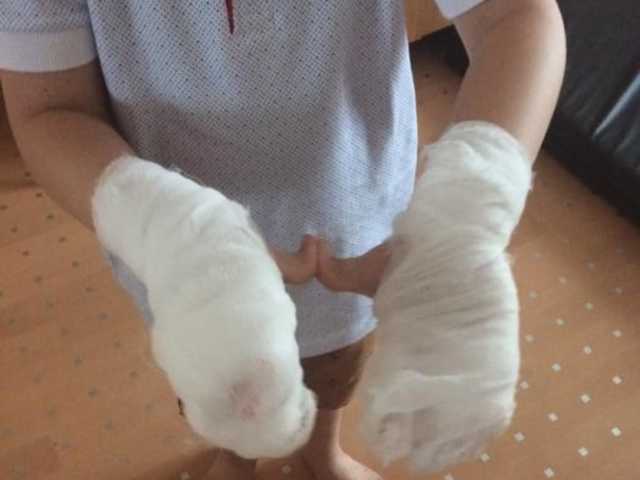 В Николаеве на дне рождения ребенка облили жидким азотом