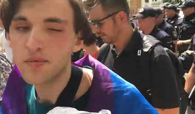Марш равенства в Киеве: журналист чуть не лишился глаза из-за яйца