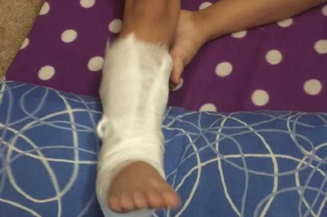 Нога сломана, все молчат: в детсаду на Запорожье вспыхнул скандал