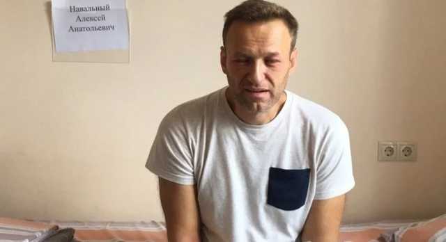 «Менты были шокированы моим видом»: Навальный рассказал, как его «травили»