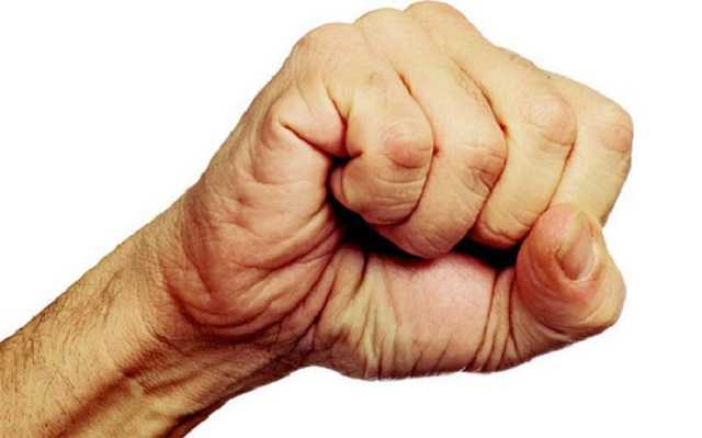 В Кременчуге охранники ночного клуба сломали нос прокурору