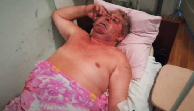 Жорстоко побили голову Асоціації фермерів Подільського району Одещини