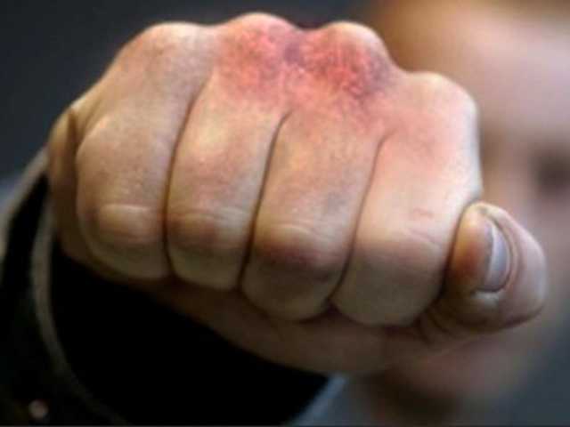 В Киеве хулиганы разбили голову приехавшему на вызов полицейскому