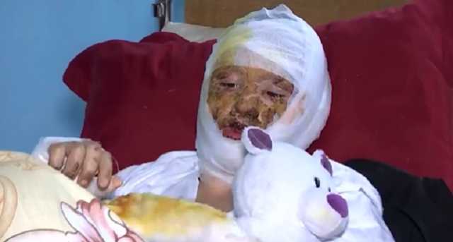 Отец поджег 16-летнюю дочь в Черновцах: выяснились детали зверской расправы