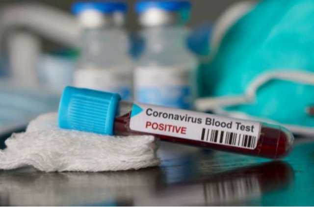 Беларусь стремительно оккупирует коронавирус