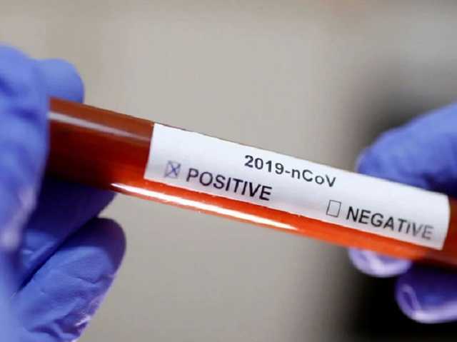 "Евровидение" под угрозой: в Нидерландах скончалась жертва коронавируса