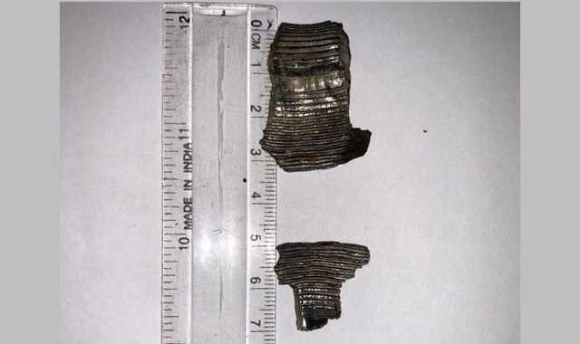 Осколок прошел через глаз: стало известно о состоянии раненых на Донбассе бойцов ВСУ