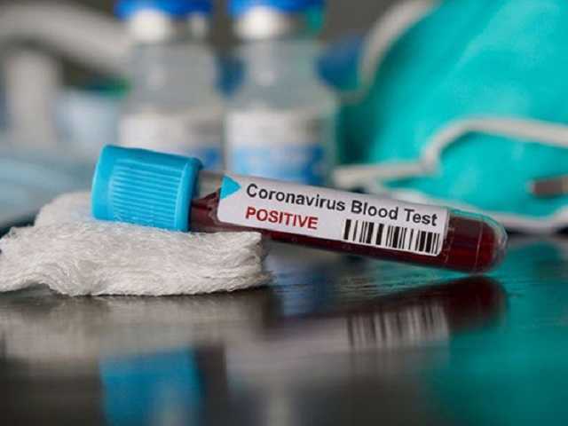 В Италии от коронавируса вылечили «нулевого пациента»