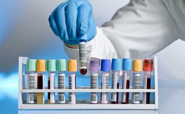 Стало відомо, в яких районах Київської області виявили COVID-19