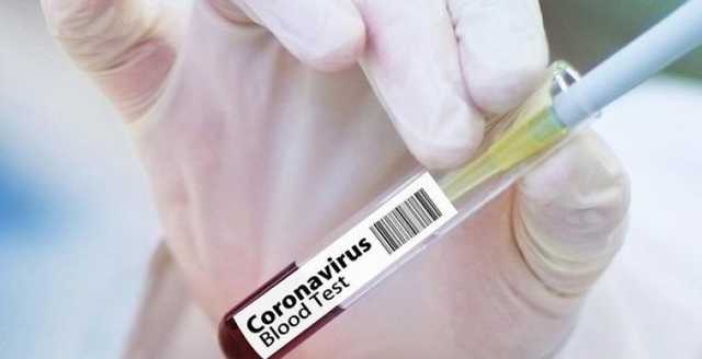 В Харькове подтвердили первый случай коронавируса