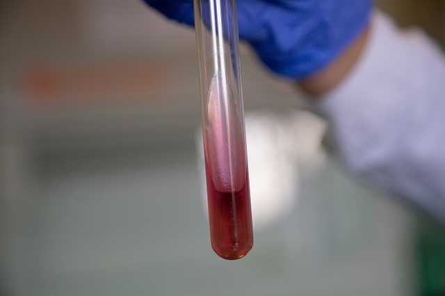 Коронавирусом в мире заразились более 600 тысяч человек