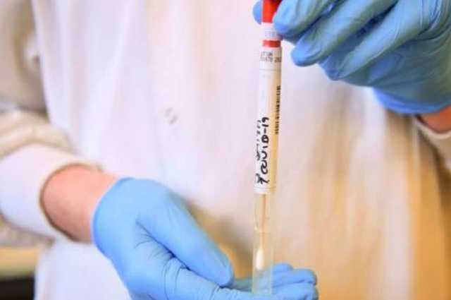 На Рівненщині від коронавірусу померла 58-річна жінка