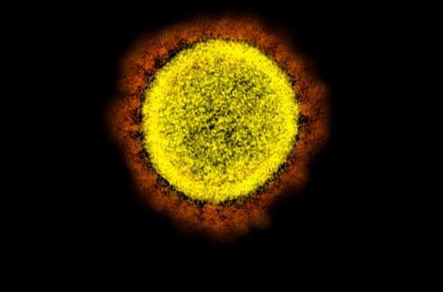 Ученые назвали температуру, "убивающую" коронавирус